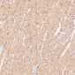 Anti-p95/NBS1 NBN Rabbit Monoclonal Antibody