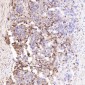 Anti-Lysozyme LYZ Rabbit Monoclonal Antibody