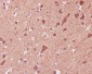 Anti-p38 MAPK MAPK14 Rabbit Monoclonal Antibody