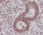 Anti-IKB beta Rabbit Monoclonal Antibody