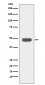 Anti-IKB beta Rabbit Monoclonal Antibody