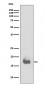 Anti-IL1 beta Rabbit Monoclonal Antibody