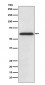 Anti-Catalase Rabbit Monoclonal Antibody