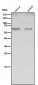 Anti-Catalase Rabbit Monoclonal Antibody