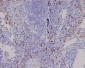 Anti-CD8 alpha Rabbit Monoclonal Antibody