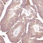 Anti-CD8 alpha Rabbit Monoclonal Antibody