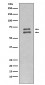 Anti-Lamin A/C LMNA Rabbit Monoclonal Antibody