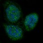 Anti-p27 KIP 1 CDKN1B Rabbit Monoclonal Antibody