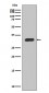 Anti-p27 KIP 1 CDKN1B Rabbit Monoclonal Antibody
