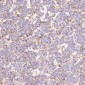 Anti-PKC alpha PRKCA Rabbit Monoclonal Antibody