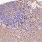 Anti-PKC alpha PRKCA Rabbit Monoclonal Antibody