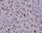 Anti-Cyclin D1 CCND1 Rabbit Monoclonal Antibody