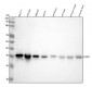 Anti-Cyclin D1 CCND1 Rabbit Monoclonal Antibody