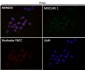 Anti-Cyclin D1 CCND1 Rabbit Monoclonal Antibody