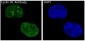 Anti-Cyclin D1 CCND1 Rabbit Monoclonal Antibody