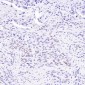 Anti-Cyclin D1 CCND1 Rabbit Monoclonal Antibody