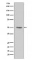 Anti-Cyclin E1 CCNE1 Rabbit Monoclonal Antibody