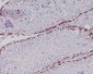 Anti-Caspase-2 CASP2 Rabbit Monoclonal Antibody