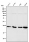 Anti-HP1 alpha CBX5 Rabbit Monoclonal Antibody