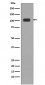 Anti-KDM1/LSD1 KDM1A Rabbit Monoclonal Antibody