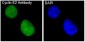 Anti-Cyclin E2 CCNE2 Rabbit Monoclonal Antibody