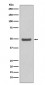 Anti-Cyclin E2 CCNE2 Rabbit Monoclonal Antibody