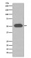 Anti-GC / VDBP Rabbit Monoclonal Antibody