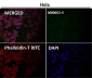 Anti-E Cadherin Rabbit Monoclonal Antibody