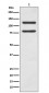 Anti-E Cadherin Rabbit Monoclonal Antibody