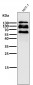 Anti-E Cadherin Rabbit Monoclonal Antibody