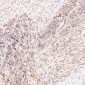 Anti-N-Cadherin-2 CDH2 CD325-Rabbit Monoclonal Antibody