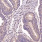 Anti-N-Cadherin-2 CDH2 CD325-Rabbit Monoclonal Antibody