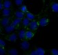 Anti-Caveolin-1 CAV1 Rabbit Monoclonal Antibody