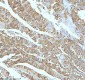 Anti-Stathmin 1 STMN1 Rabbit Monoclonal Antibody