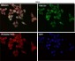 Anti-p62/SQSTM1 Rabbit Monoclonal Antibody