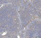 Anti-p62/SQSTM1 Rabbit Monoclonal Antibody