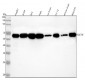 Anti-p62/SQSTM1 Rabbit Monoclonal Antibody