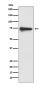 Anti-Tyrosinase Rabbit Monoclonal Antibody