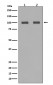 Anti-Aconitase 1 ACO1 Rabbit Monoclonal Antibody