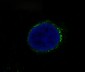 Anti-Met (c-Met) Rabbit Monoclonal Antibody