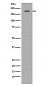 Anti-Met (c-Met) Rabbit Monoclonal Antibody