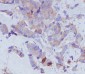 Anti-Transferrin TF Rabbit Monoclonal Antibody