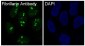 Anti-Fibrillarin FBL Rabbit Monoclonal Antibody