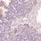 Anti-CD3 epsilon Rabbit Monoclonal Antibody