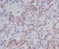 Anti-Fibronectin FN1 Rabbit Monoclonal Antibody