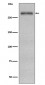 Anti-Fibronectin FN1 Rabbit Monoclonal Antibody