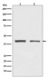 Anti-hnRNP C1/C2 Rabbit Monoclonal Antibody