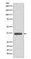 Anti-Annexin A10 Rabbit Monoclonal Antibody