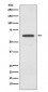 Anti-Glutaminase GLS Rabbit Monoclonal Antibody