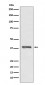 Anti-AMPK beta 1 PRKAB1 Rabbit Monoclonal Antibody